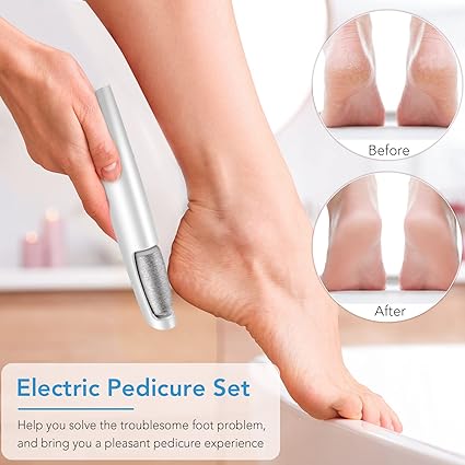 Foot File Callus